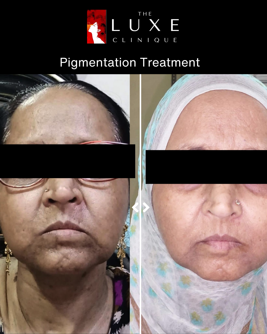 Skin Treatment 2
